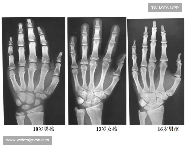 全国青少年骨龄检测全覆盖成效显著 阻截三起年龄造假案件 全国青少年骨龄检测全覆盖成效显著 阻截三起年龄造假案件